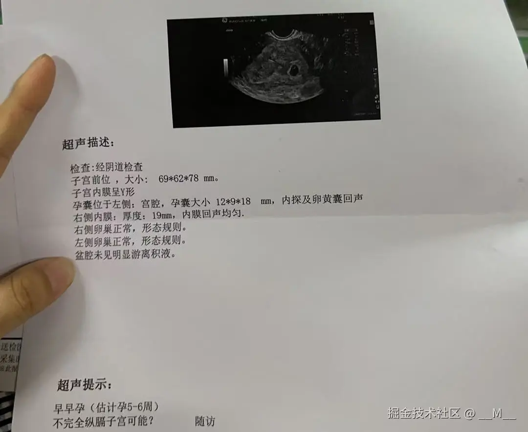 __M__于2025-05-08 17:55发布的图片