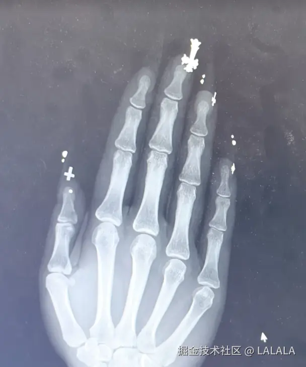 LALALA于2026-02-26 16:14发布的图片