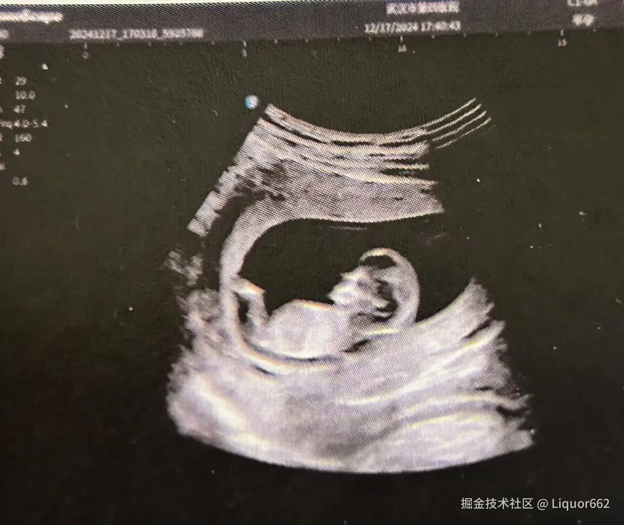 Liquor662于2024-12-27 09:24发布的图片