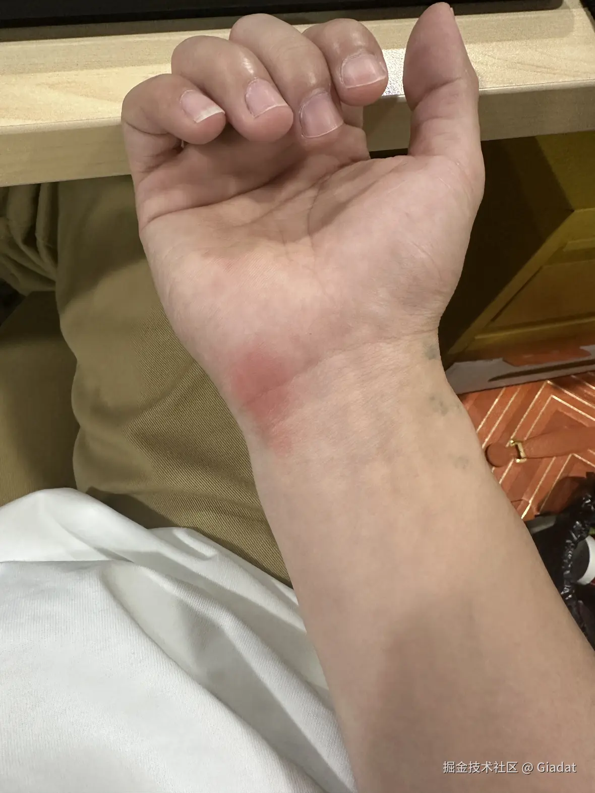 Giadat于2025-03-25 16:23发布的图片