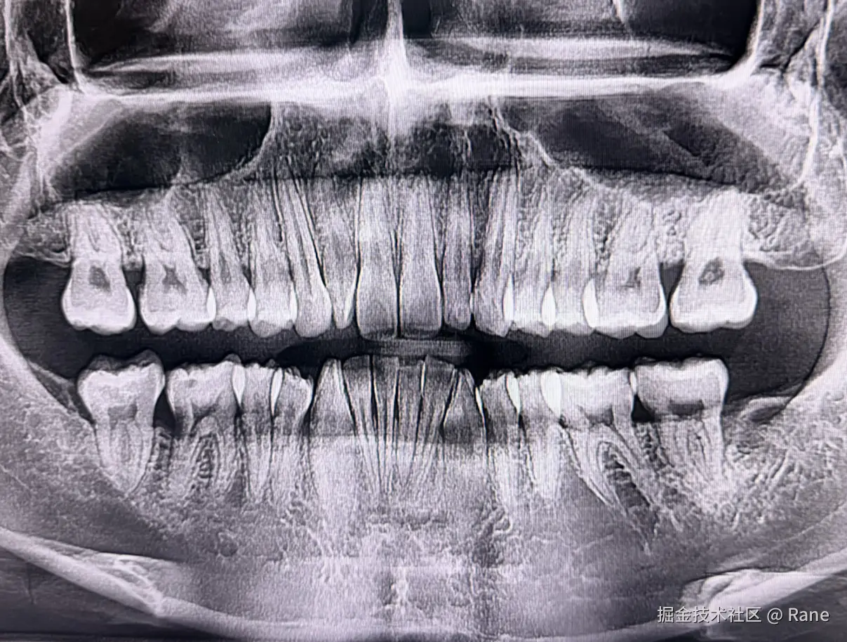 Rane于2026-01-04 10:05发布的图片