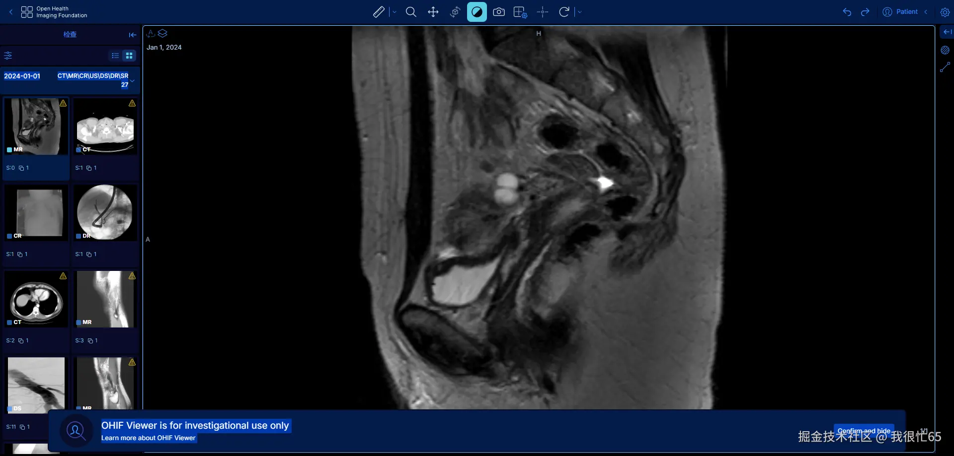 医学CT影像技术