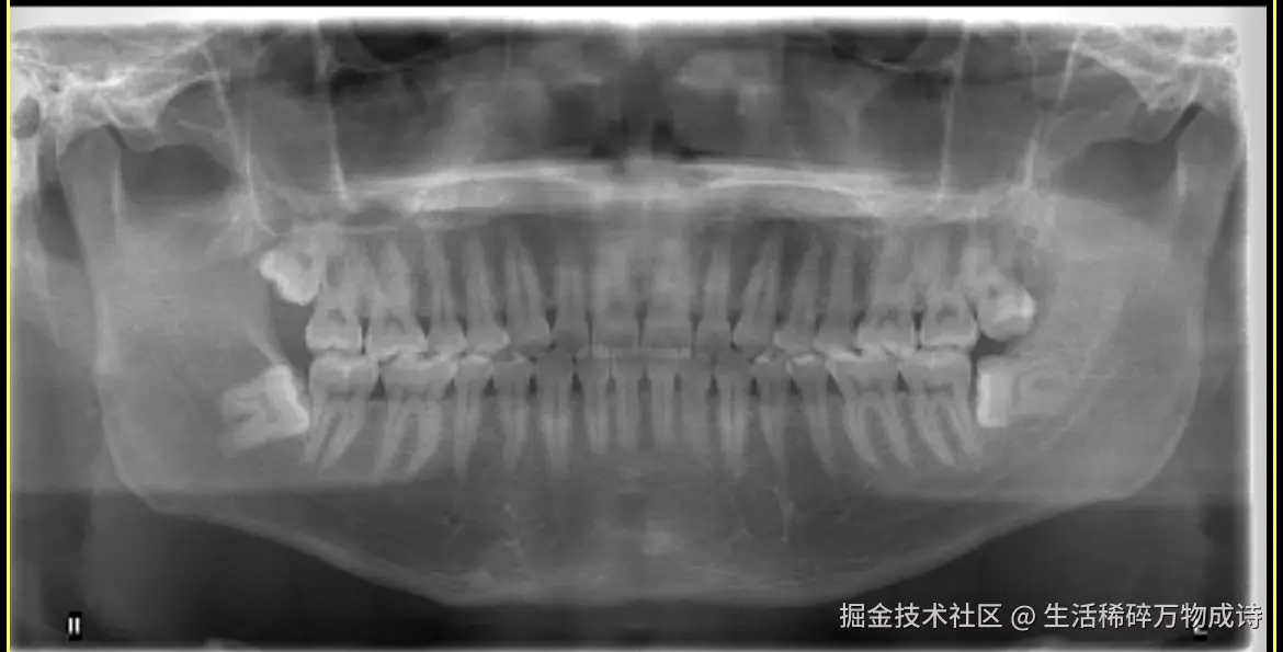 生活稀碎万物成诗于2026-01-10 13:11发布的图片