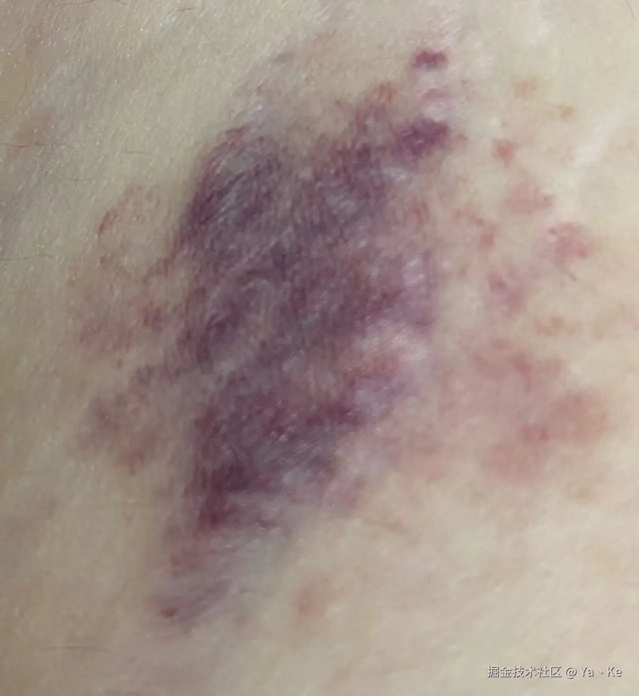 Ya丶Ke于2025-06-16 11:40发布的图片