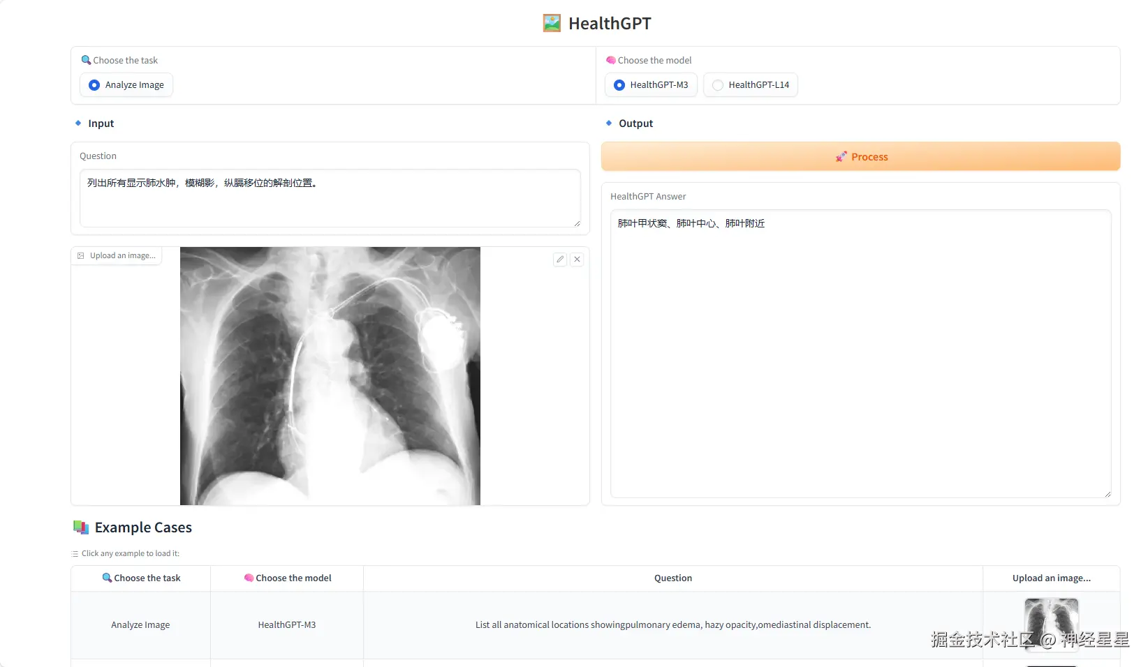 神经星星于2025-07-07 18:07发布的图片