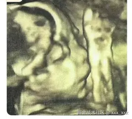 xxx_xxx于2025-07-07 16:07发布的图片