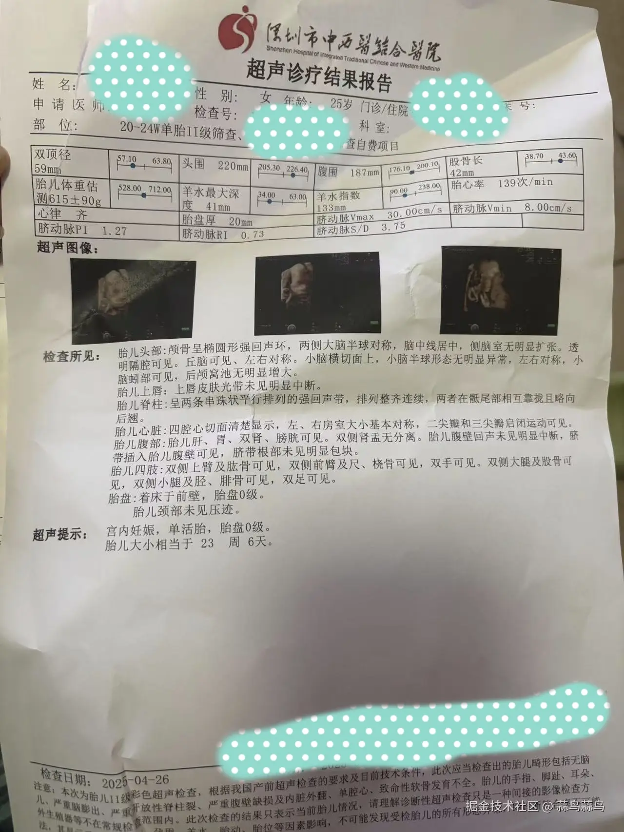 蒜鸟蒜鸟于2025-05-23 15:43发布的图片