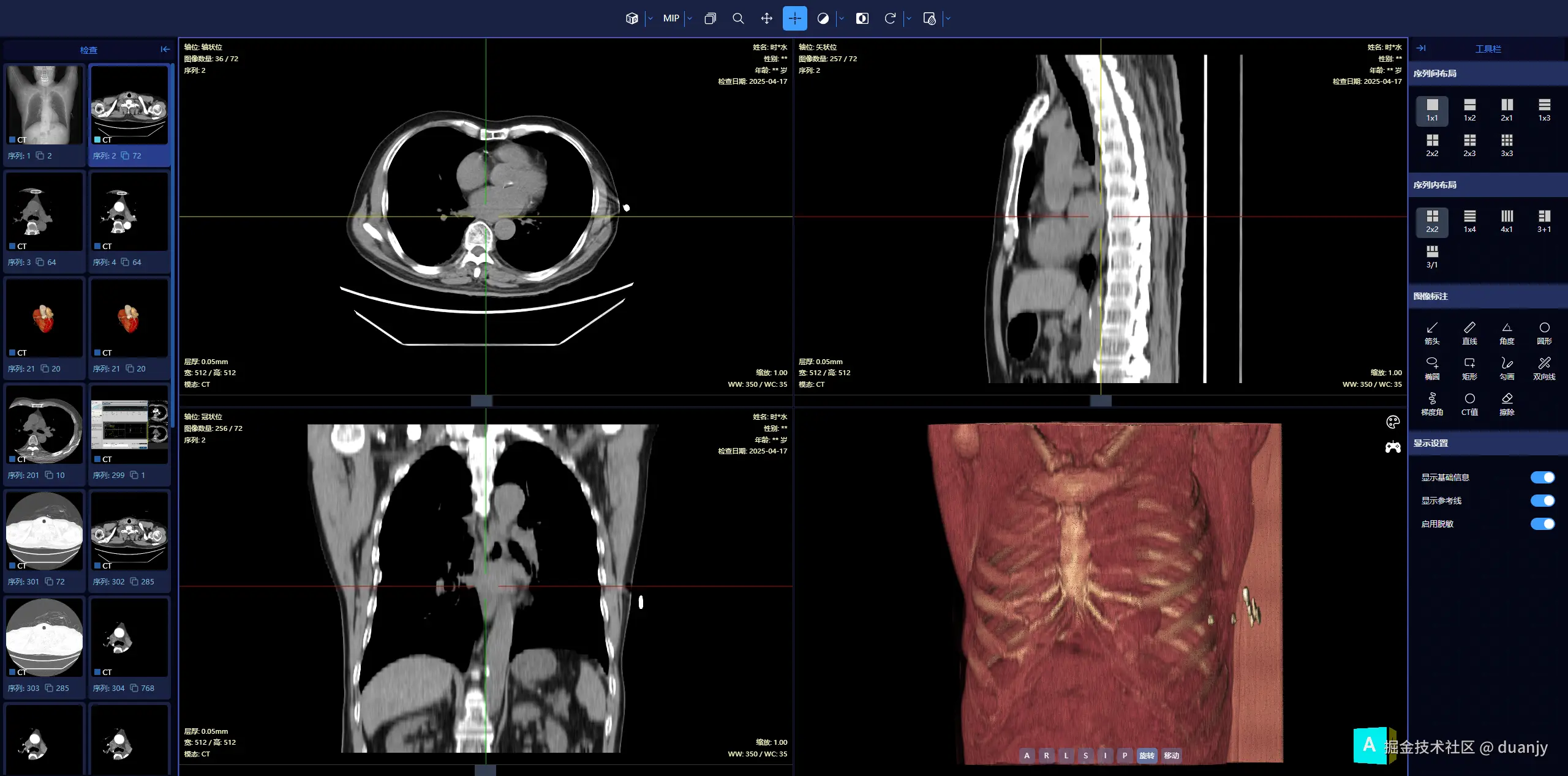 Dicom Web Viewer